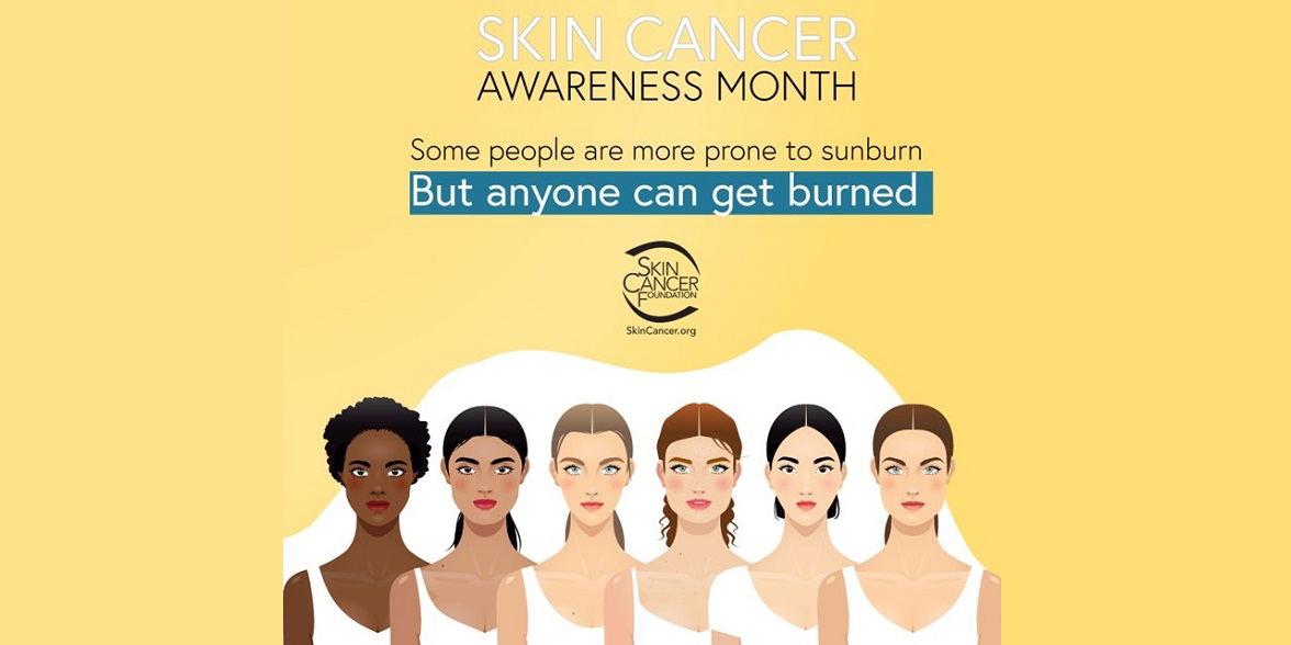 Sun safety guide: Skin cancer prevention | Amway United States